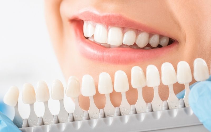 cosmetic dentist herndon va