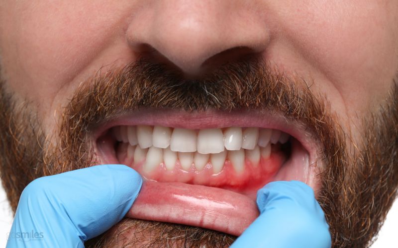 gum disease treatment in herndon va