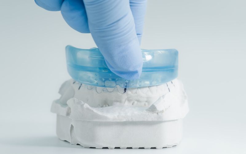 best dentist in gainesville va custom mouthguard