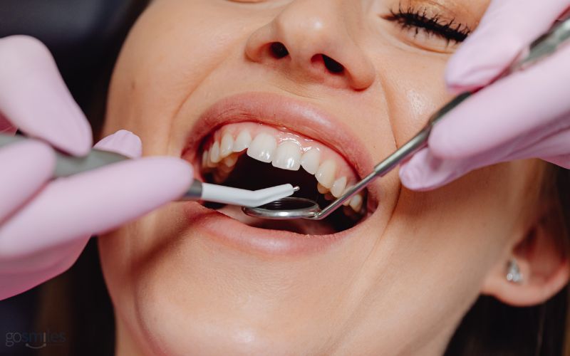 dental crowns in gainesville va